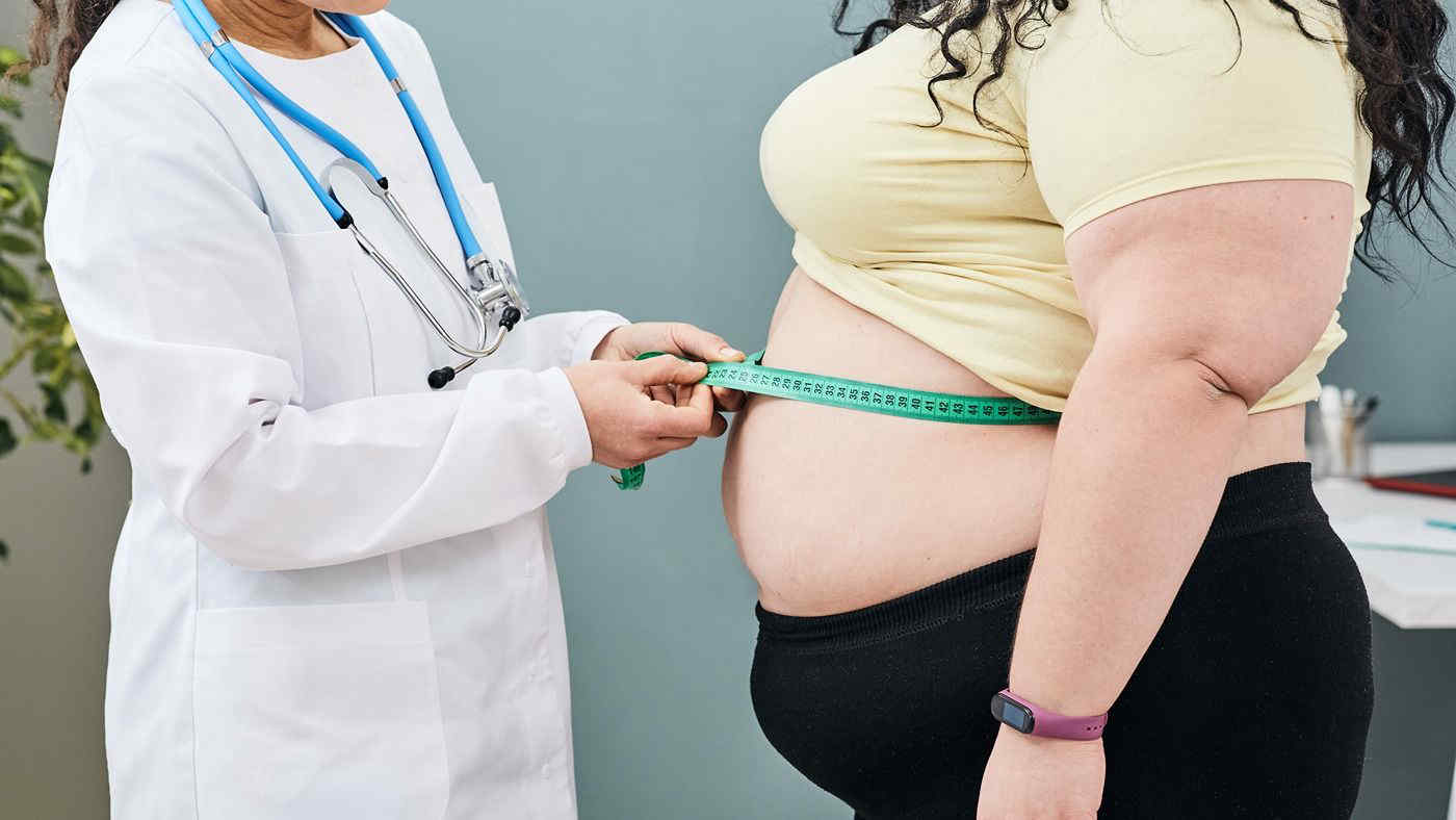 Obesità riconosciuta come malattia: l'Italia è il primo paese al mondo a farlo